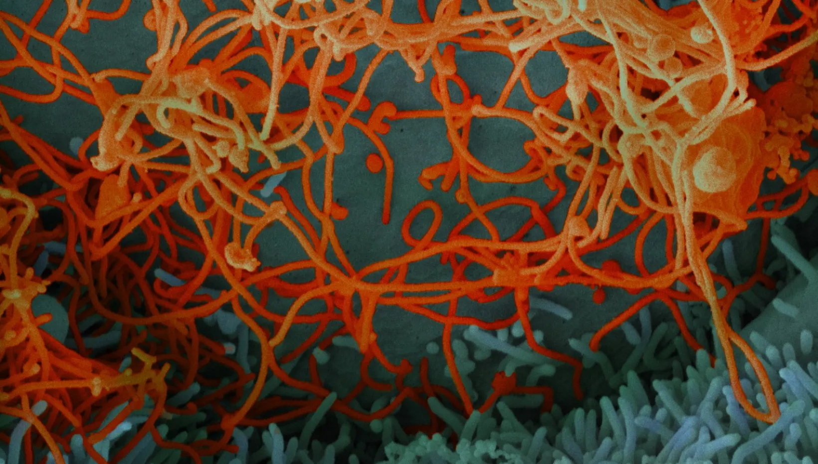 Virus in microbiology environment