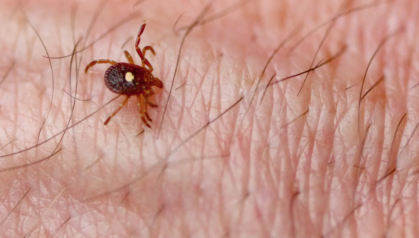 Human monocytic ehrlichiosis is caused by the bite of infected ticks, including the lone star tick (Amblyomma americanum).