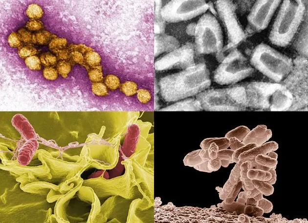 An image of four zoonotic diseases 