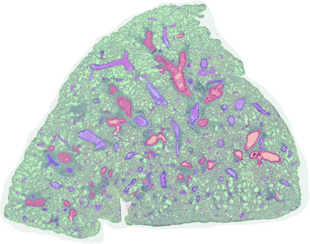 Artificial Intelligence (AI)-generated overlay on a hematoxylin and eosin (H&E)-stained lung section from a mouse challenged with the infectious agent that causes COVID-19 (SARS-CoV-2).