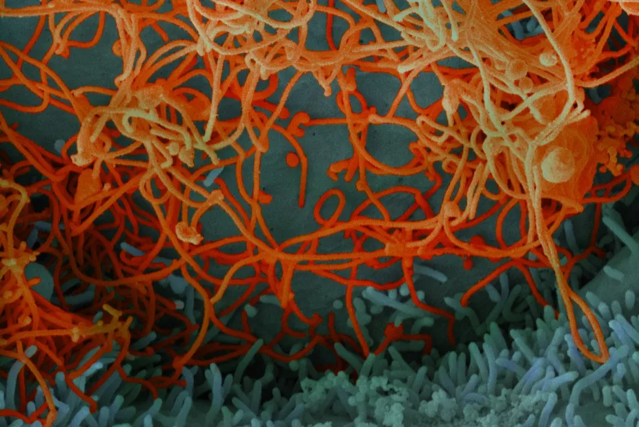 Virus in microbiology environment
