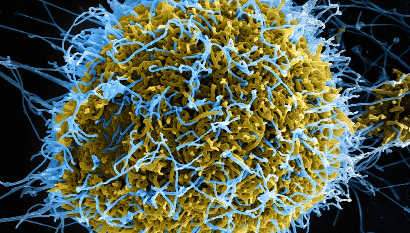 A colorized scanning electron micrograph of Ebola virus particles, in blue, budding from a chronically infected cell. New Ohio State research shows that the cell-signaling activities of proteins from the SERINC family helped protect cells from infection by Ebola, HIV and Zika viruses.