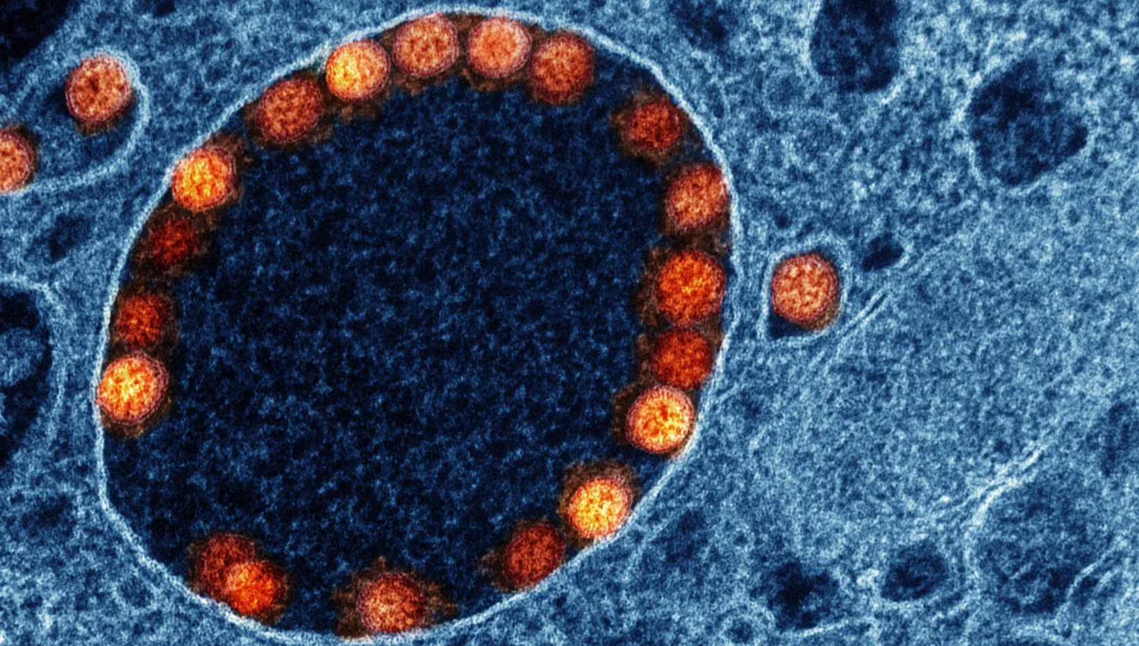 Researchers will conduct studies in mice and human cell samples – including epithelial cells, the type of cell infected by SARS-CoV-2 in this image. Transmission electron micrograph image: NIAID