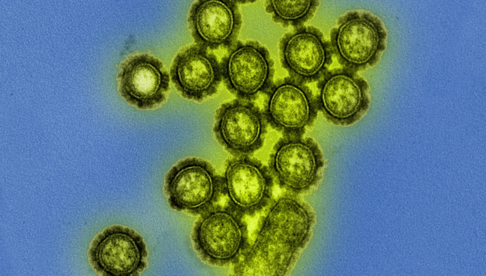 A colorized transmission electron micrograph of H1N1 influenza virus particles, one of the Influenza A subtypes neutralized by the engineered IgM antibody. Image: National Institute of Allergy and Infectious Diseases