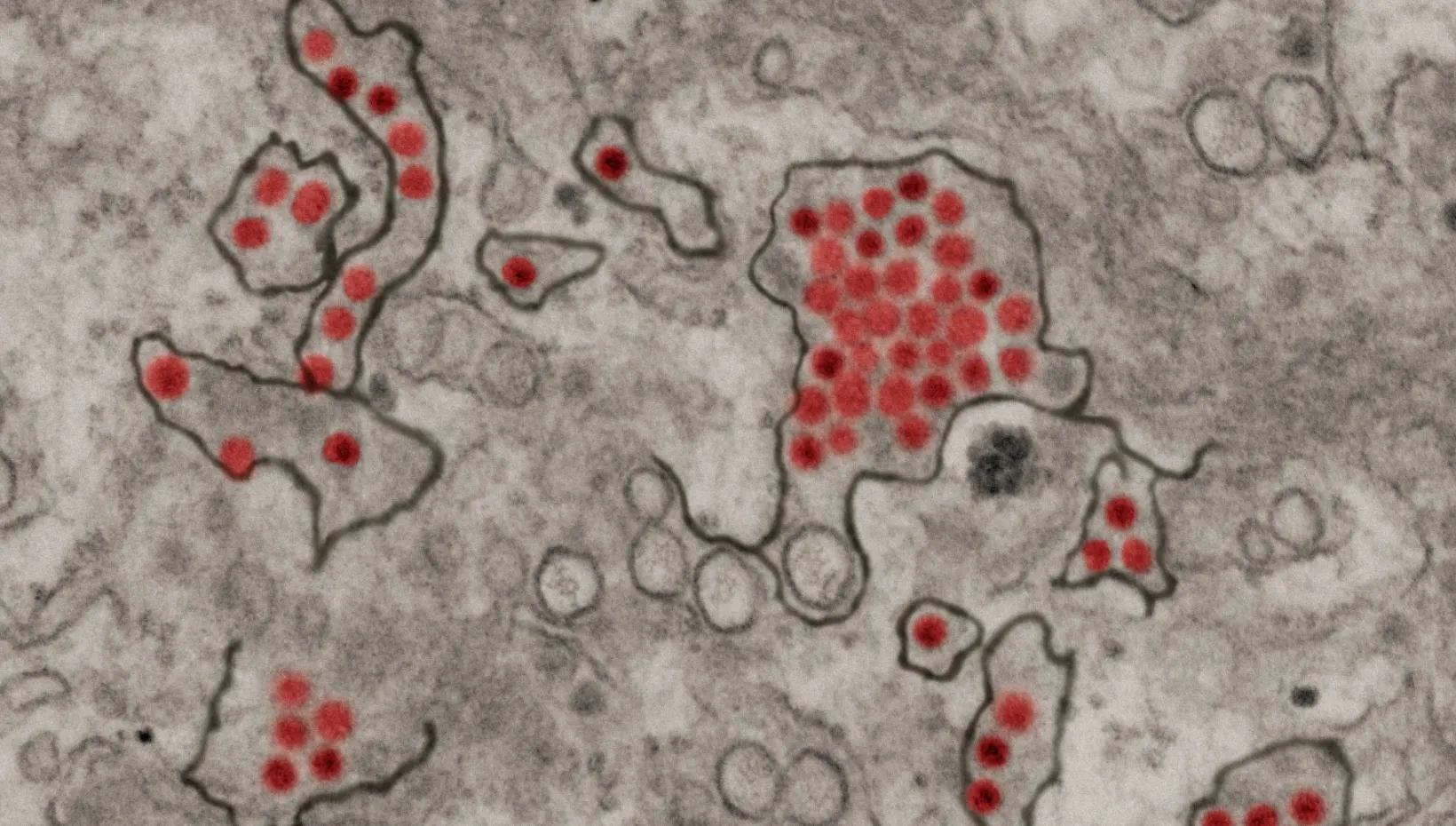 slide of zika particles