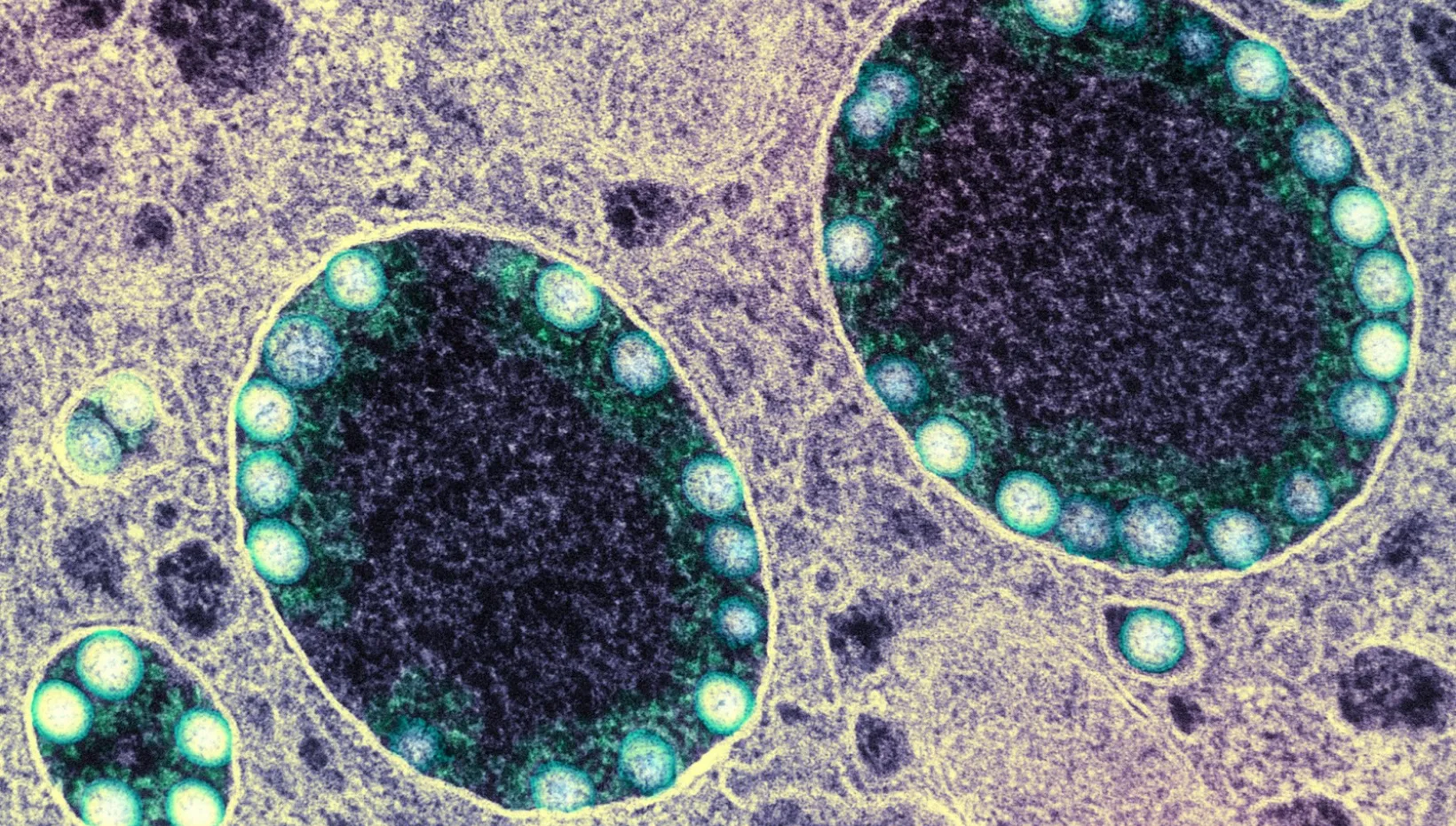 Neutralizing antibodies that block viral particles’ entry into host cells are considered the gold standard of protection against COVID-19 infection. Above, SARS-CoV-2 virus particles are visible inside a heavily infected nasal cell.