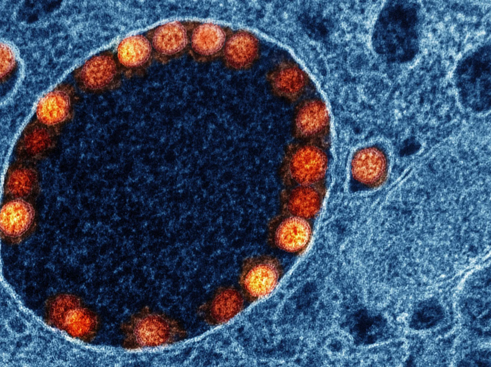 Researchers will conduct studies in mice and human cell samples – including epithelial cells, the type of cell infected by SARS-CoV-2 in this image. Transmission electron micrograph image: NIAID