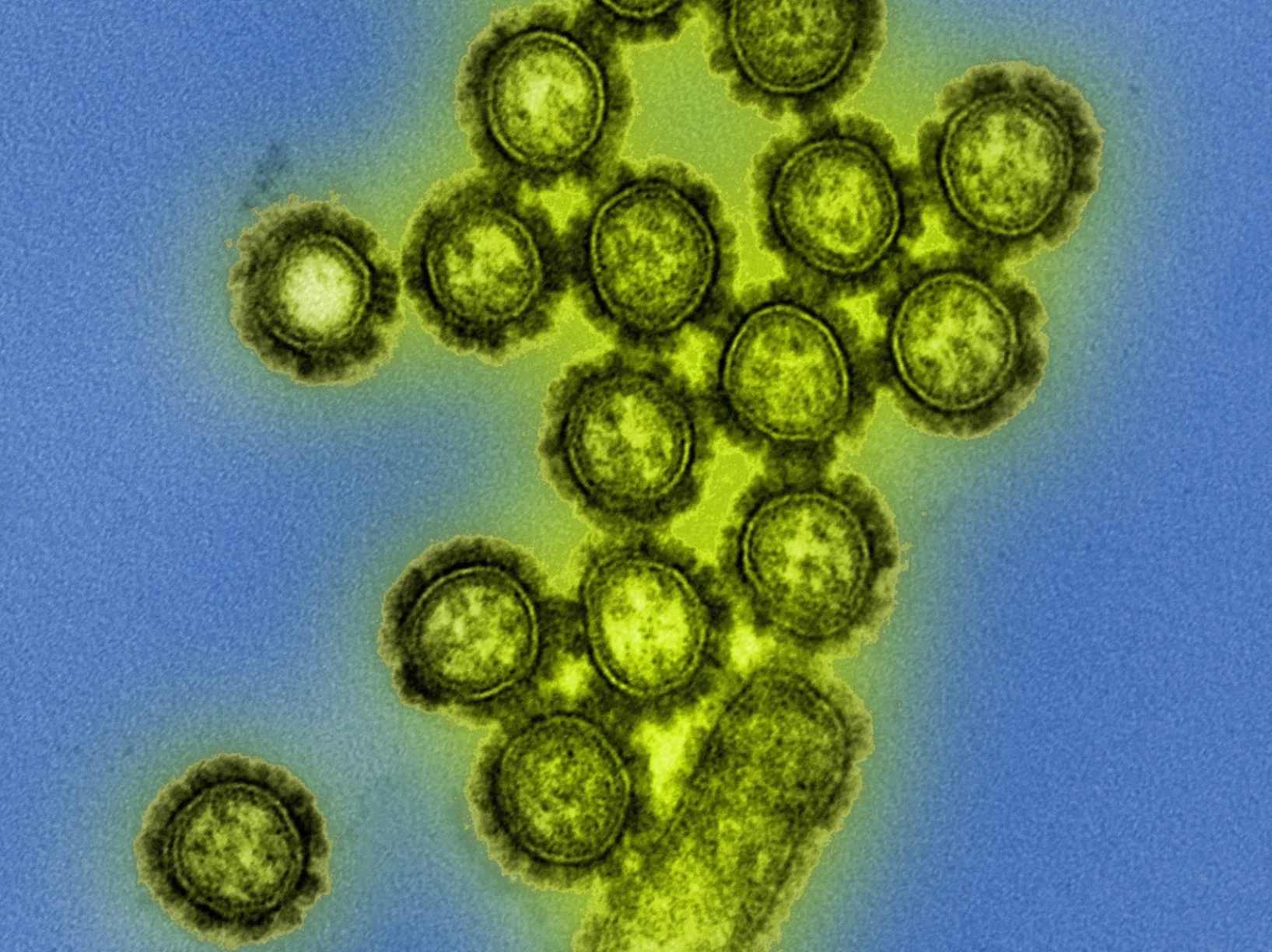 A colorized transmission electron micrograph of H1N1 influenza virus particles, one of the Influenza A subtypes neutralized by the engineered IgM antibody. Image: National Institute of Allergy and Infectious Diseases