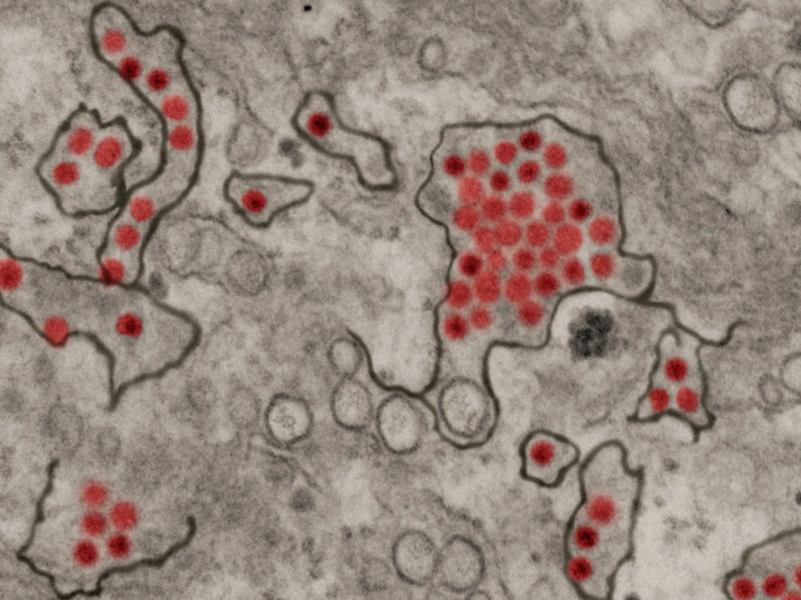 slide of zika particles