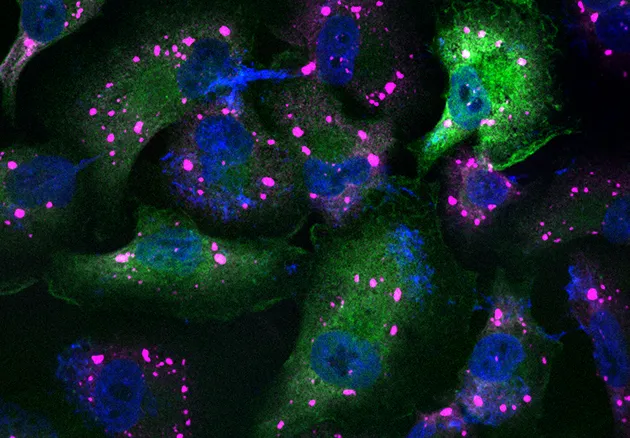 Immunofluorescence staining demonstrating that MG53 overexpression  (green) suppresses stress granule formation (marked by pin