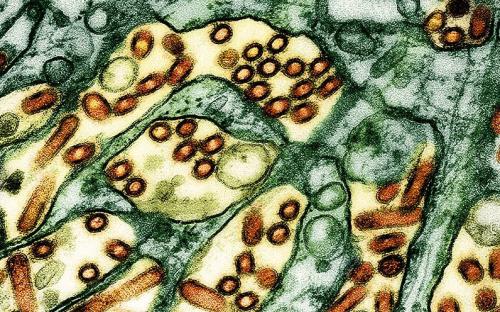 Colorized transmission electron micrograph of avian influenza A H5N1 virus particles. Image: NIAID